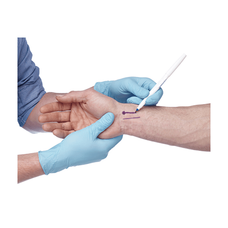 Surgical Skin Marking Pens - UN65-B