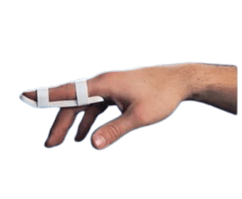 A-2 Plastalume Digital Zimmer Splint - 2.25" / 58mm (12)