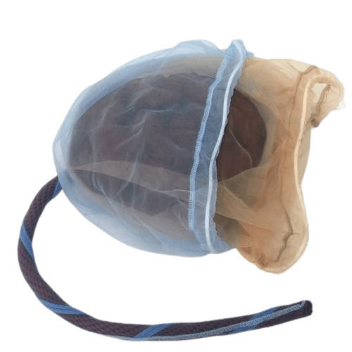 Placenta and Umbilical Cord